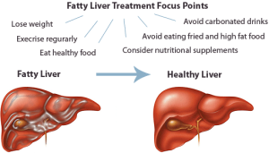 reverse the fatty liver 