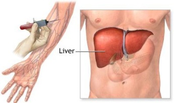 fatty liver blood test